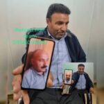کلینیک تخصصی کاشت مو رحیمی در تبریز