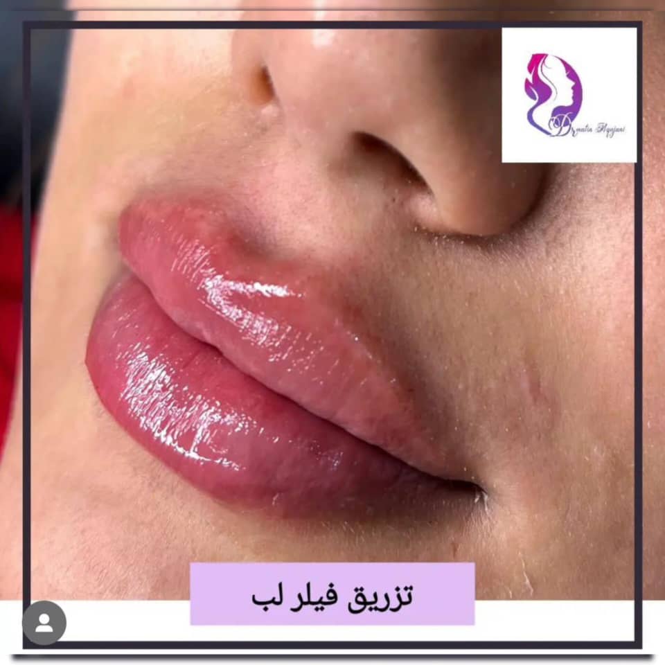 مطب پوست مو زیبایی دکتر متین آقاجانی | بهترین پزشک زیبایی در نوشهر