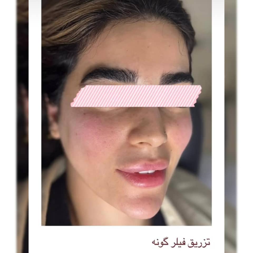 مطب پوست مو زیبایی دکتر متین آقاجانی | بهترین پزشک زیبایی در نوشهر
