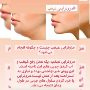 خدمات پوست مو زیبایی دکتر امیر حاجی رجبی | بهترین پزشک زیبایی در شیراز