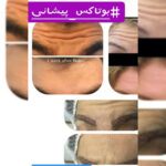 خدمات پوست مو زیبایی دکتر امیر حاجی رجبی | بهترین پزشک زیبایی در شیراز