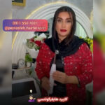 بهترین مرکز احیا و صافی مو رشت پیوسته 💯 خدمات اسکراب اسکالپ سر در رشت