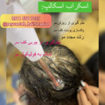 بهترین مرکز احیا و صافی مو رشت پیوسته 💯 خدمات اسکراب اسکالپ سر در رشت