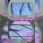 بهترین مرکز احیا و صافی مو رشت پیوسته 💯 خدمات اسکراب اسکالپ سر در رشت