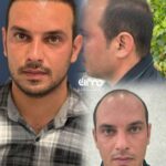 بهترین دکتر کاشت مو در قزوین ✨️ کلینیک زیبایی آرمو 💯 مرکز تخصصی کاشت ابرو و ریش در قزوین